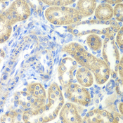 NDUFV2 Antibody - Immunohistochemistry of paraffin-embedded rat kidney tissue.