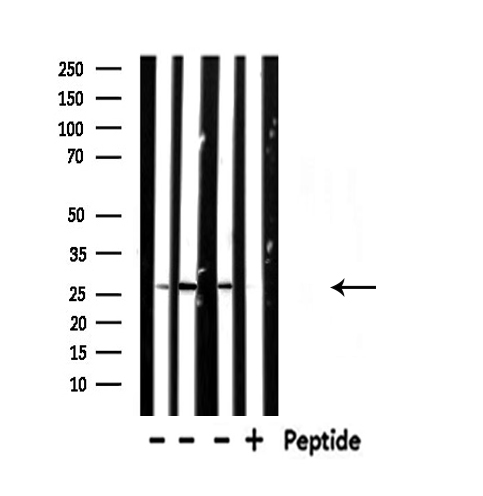 NDUFV2 Antibody - Western blot analysis of NDUFV2 expression in various lysates