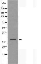 NDUFV2 Antibody - Western blot analysis of extracts of Jurkat cells using NDUFV2 antibody.