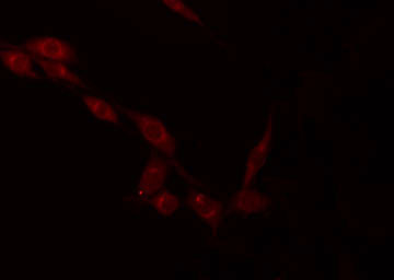 NDUFV2 Antibody - Staining HeLa cells by IF/ICC. The samples were fixed with PFA and permeabilized in 0.1% Triton X-100, then blocked in 10% serum for 45 min at 25°C. The primary antibody was diluted at 1:200 and incubated with the sample for 1 hour at 37°C. An Alexa Fluor 594 conjugated goat anti-rabbit IgG (H+L) Ab, diluted at 1/600, was used as the secondary antibody.