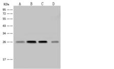 NDUFV2 Antibody - Anti-NDUFV2 rabbit polyclonal antibody at 1:500 dilution. Lane A: A549 Whole Cell Lysate. Lane B: Jurkat Whole Cell Lysate. Lane C: HeLa Whole Cell Lysate. Lane D: A431 Whole Cell Lysate. Lysates/proteins at 30 ug per lane. Secondary: Goat Anti-Rabbit IgG (H+L)/HRP at 1/10000 dilution. Developed using the ECL technique. Performed under reducing conditions. Predicted band size: 27 kDa. Observed band size: 27 kDa.