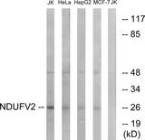 NDUFV2 Antibody - Western blot analysis of extracts from Jurkat cells, HeLa cells, HepG2 cells and MCF-7 cells, using NDUFV2 antibody.