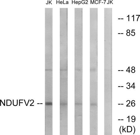 NDUFV2 Antibody - Western blot analysis of extracts from Jurkat cells, HeLa cells, HepG2 cells and MCF-7 cells, using NDUFV2 antibody.