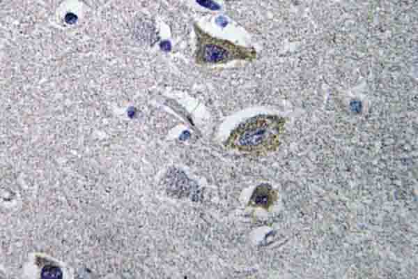 NDUFV2 Antibody - IHC of NDUFV2 (P52) pAb in paraffin-embedded human brain tissue.