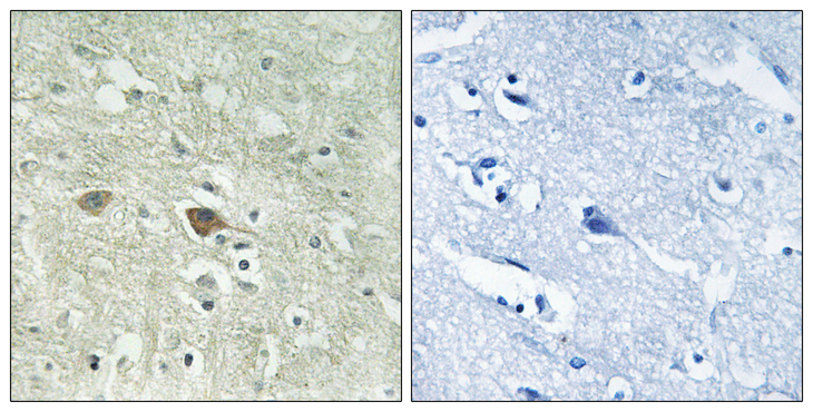 NDUFV3 Antibody - Immunohistochemistry analysis of paraffin-embedded human brain, using NDUFV3 Antibody. The picture on the right is blocked with the synthesized peptide.