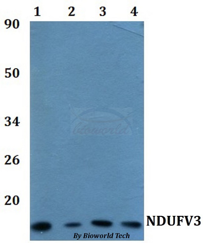 NDUFV3 Antibody - Western blot of NDUFV3 antibody at 1:500 dilution. Lane 1: HEK293T whole cell lysate. Lane 2: RAW264.7 whole cell lysate.