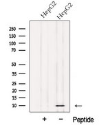 NDUFV3 Antibody - Western blot analysis of extracts of HepG2 cells using NDUFV3 antibody. The lane on the left was treated with blocking peptide.