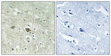 NDUFV3 Antibody - Peptide - + Immunohistochemistry analysis of paraffin-embedded human brain tissue using NDUFV3 antibody.