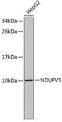 NDUFV3 Antibody - Western blot analysis of extracts of HepG2 cells using NDUFV3 Polyclonal Antibody.