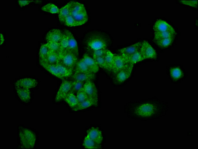 NEB / Nebulin Antibody - Immunofluorescence staining of HepG2 cells at a dilution of 1:200, counter-stained with DAPI. The cells were fixed in 4% formaldehyde, permeabilized using 0.2% Triton X-100 and blocked in 10% normal Goat Serum. The cells were then incubated with the antibody overnight at 4 °C.The secondary antibody was Alexa Fluor 488-congugated AffiniPure Goat Anti-Rabbit IgG (H+L) .
