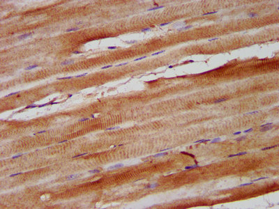 NEB / Nebulin Antibody - Immunohistochemistry image at a dilution of 1:600 and staining in paraffin-embedded human skeletal muscle tissue performed on a Leica BondTM system. After dewaxing and hydration, antigen retrieval was mediated by high pressure in a citrate buffer (pH 6.0) . Section was blocked with 10% normal goat serum 30min at RT. Then primary antibody (1% BSA) was incubated at 4 °C overnight. The primary is detected by a biotinylated secondary antibody and visualized using an HRP conjugated SP system.