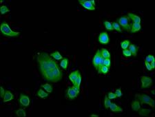 NEBL LASP2 Antibody - Immunofluorescence staining of PC3 cells diluted at 1:133, counter-stained with DAPI. The cells were fixed in 4% formaldehyde, permeabilized using 0.2% Triton X-100 and blocked in 10% normal Goat Serum. The cells were then incubated with the antibody overnight at 4°C.The Secondary antibody was Alexa Fluor 488-congugated AffiniPure Goat Anti-Rabbit IgG (H+L).