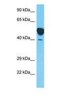 NECAB1 Antibody - Western blot of NECA1 Antibody with human Thymus Tumor lysate.  This image was taken for the unconjugated form of this product. Other forms have not been tested.