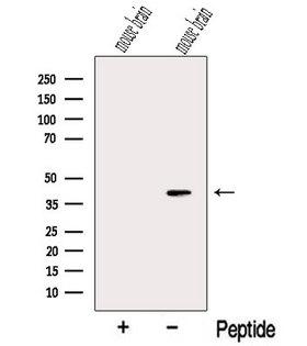 NECAP1 Antibody - Western blot analysis of extracts of mouse brain tissue using NECAP1 antibody. The lane on the left was treated with blocking peptide.