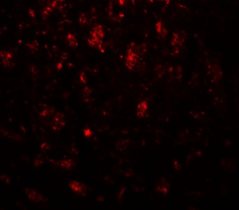 NECL-1 / CADM3 Antibody - Immunofluorescence of CADM3 in mouse brain tissue with CADM3 antibody at 20 ug/ml.