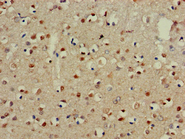 NECL-1 / CADM3 Antibody - Immunohistochemistry of paraffin-embedded human brain tissue at dilution of 1:100