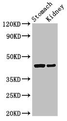 NECL-1 / CADM3 Antibody - Western Blot Positive WB detected in:Rat stomach tissue,Mouse kidney tissue All Lanes:CADM3 antibody at 3µg/ml Secondary Goat polyclonal to rabbit IgG at 1/50000 dilution Predicted band size: 44,48,39 KDa Observed band size: 44 KDa