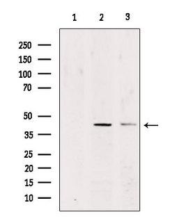 NECL-1 / CADM3 Antibody - Western blot analysis of extracts of various samples using CADM3 antibody. Lane 1: rat brain treated with blocking peptide. Lane 2: rat brain; Lane 3: mouse carcinoma;