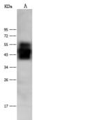 NECL-1 / CADM3 Antibody - Anti-CADM3 rabbit polyclonal antibody at 1:500 dilution. Lane A: Mouse Brain Whole Cell Lysate. Lysates/proteins at 30 ug per lane. Secondary: Goat Anti-Rabbit IgG (H+L)/HRP at 1/10000 dilution. Developed using the ECL technique. Performed under reducing conditions. Predicted band size: 43 kDa. Observed band size: 45 kDa.