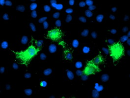 Nectin-1 / PVRL1 Antibody - Anti-PVRL1 mouse monoclonal antibody immunofluorescent staining of COS7 cells transiently transfected by pCMV6-ENTRY PVRL1.
