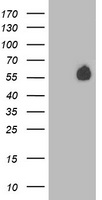 Nectin-1 / PVRL1 Antibody - HEK293T cells were transfected with the pCMV6-ENTRY control (Left lane) or pCMV6-ENTRY PVRL1 (Right lane) cDNA for 48 hrs and lysed. Equivalent amounts of cell lysates (5 ug per lane) were separated by SDS-PAGE and immunoblotted with anti-PVRL1.