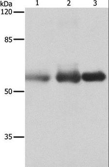 Nectin-1 / PVRL1 Antibody - Western blot analysis of Human cervical cancer, legs fibrous histiocytoma and fetal brain tissue, using PVRL1 Polyclonal Antibody at dilution of 1:400.