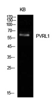 Nectin-1 / PVRL1 Antibody - Western Blot analysis of extracts from KB cells using PVRL1 Antibody.