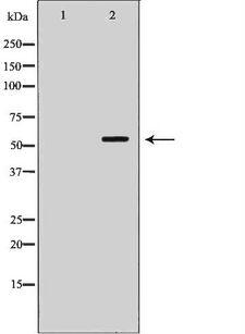Nectin-1 / PVRL1 Antibody - Western blot analysis of extracts of HepG2 cells using PVRL1 antibody. The lane on the left is treated with the antigen-specific peptide.