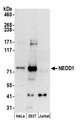 NEDD1 Antibody - Detection of human NEDD1 by western blot. Samples: Whole cell lysate (50 µg) from HeLa, HEK293T, and Jurkat cells prepared using NETN lysis buffer. Antibodies: Affinity purified rabbit anti-NEDD1 antibody used for WB at 0.1 µg/ml. Detection: Chemiluminescence with an exposure time of 3 minutes.