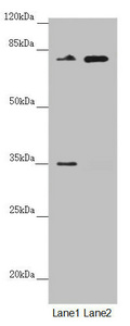 NEDD1 Antibody - Western blot All Lanes:NEDD1 antibody at 2.66 ug/ml Lane 1: Mouse brain tissue Lane 2: Jurkat whole cell lysate Secondary Goat polyclonal to rabbit IgG at 1/10000 dilution Predicted band size: 72,63,73 kDa Observed band size: 72,35 kDa