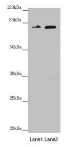NEDD1 Antibody - Western blot All lanes: NEDD1 antibody at 2.66µg/ml Lane 1: Mouse brain tissue Lane 2: Jurkat whole cell lysate Secondary Goat polyclonal to rabbit IgG at 1/10000 dilution Predicted band size: 72, 63, 73 kDa Observed band size: 72 kDa