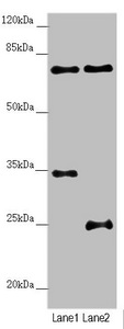 NEDD1 Antibody - Western blot All Lanes:NEDD1 antibody at 3.25 ug/ml Lane 1: Mouse small intestine tissue Lane 2: Jurkat whole cell lysate Secondary Goat polyclonal to rabbit IgG at 1/10000 dilution Predicted band size: 72,63,73 kDa Observed band size: 72,35,25 kDa