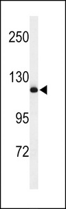 NEDD4 Antibody - Western blot of NEDD4 Antibody in mouse NIH-3T3 cell line lysates (35 ug/lane). NEDD4 (arrow) was detected using the purified antibody.