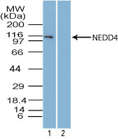 NEDD4 Antibody - Western blot of NEDD4 in mouse embryonic brain tissue lysate in the 1) absence and 2) presence of immunizing peptide using Peptide-affinity Purified Polyclonal Antibody to NEDD4 at 5 ug/ml. Goat anti-rabbit Ig HRP secondary antibody, and PicoTect ECL substrate solution were used for this test.