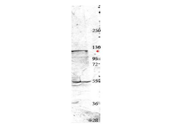 NEDD4 Antibody - Anti-Nedd4 Antibody - Western Blot. Western blot of affinity purified anti-Nedd4 antibody shows detection of a 115 kD band corresponding to endogenous Nedd4 (arrowhead) in MDA-MB-435S cell lysates. The blot was blocked with B501-0500 5% BLOTTO overnight at 4C. Primary antibody was used at a 1:350 dilution in 5% BLOTTO followed by reaction with a 1:20000 dilution of HRP goat anti-rabbit IgG in #MB-070 Blocking Buffer for Fluorescent Western Blot. ECL was used for detection.