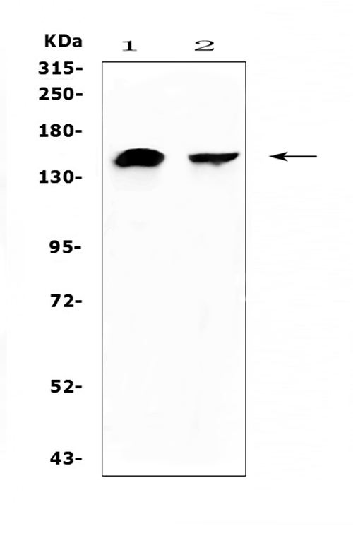 NEDD4 Antibody - Western blot analysis of NEDD4 using anti-NEDD4 antibody. Electrophoresis was performed on a 5-20% SDS-PAGE gel at 70V (Stacking gel) / 90V (Resolving gel) for 2-3 hours. The sample well of each lane was loaded with 50ug of sample under reducing conditions. Lane 1: human U-87MG whole cell lysates,Lane 2: human MDA-MB-453 whole cell lysates. After Electrophoresis, proteins were transferred to a Nitrocellulose membrane at 150mA for 50-90 minutes. Blocked the membrane with 5% Non-fat Milk/ TBS for 1.5 hour at RT. The membrane was incubated with rabbit anti-NEDD4 antigen affinity purified polyclonal antibody at 0.5 µg/mL overnight at 4°C, then washed with TBS-0.1% Tween 3 times with 5 minutes each and probed with a goat anti-rabbit IgG-HRP secondary antibody at a dilution of 1:10000 for 1.5 hour at RT. The signal is developed using an Enhanced Chemiluminescent detection (ECL) kit with Tanon 5200 system. A specific band was detected for NEDD4 at approximately 149KD. The expected band size for NEDD4 is at 149KD.