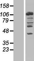 NEDD4 Protein - Western validation with an anti-DDK antibody * L: Control HEK293 lysate R: Over-expression lysate