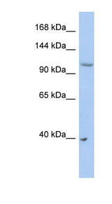 NEDD4L / NEDD4-2 Antibody - NEDD4L antibody Western blot of PANC1 cell lysate. This image was taken for the unconjugated form of this product. Other forms have not been tested.