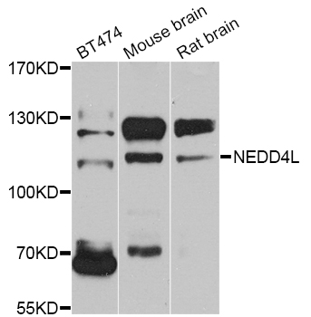 NEDD4L / NEDD4-2 Antibody - Western blot analysis of extracts of various cell lines.