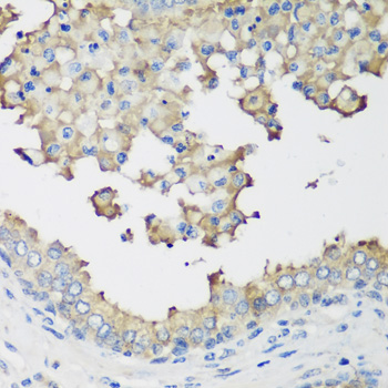 NEDD4L / NEDD4-2 Antibody - Immunohistochemistry of paraffin-embedded human prostate.