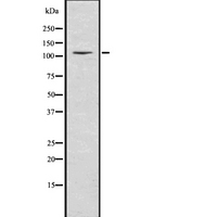 NEDD4L / NEDD4-2 Antibody - Western blot analysis of NEDD4-2 using K562 whole lysates.