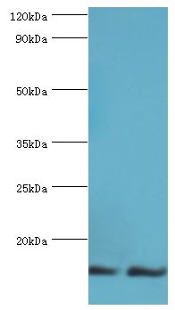 NEDD8 Antibody - Western blot. All lanes: NEDD8 antibody at 16 ug/ml. Lane 1: mouse heart tissue. Lane 2: mouse spleen tissue. Secondary antibody: Goat polyclonal to rabbit at 1:10000 dilution. Predicted band size: 9 kDa. Observed band size: 9 kDa Immunohistochemistry.