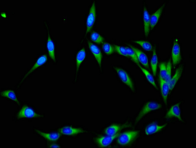 NEDD8 Antibody - Immunofluorescent analysis of Hela cells using NEDD8 Antibody at dilution of 1:100 and Alexa Fluor 488-congugated AffiniPure Goat Anti-Rabbit IgG(H+L)