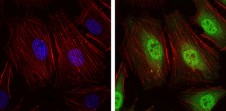 NEDD8 Antibody - Immunofluorescence of HeLa cells using NEDD8 mouse monoclonal antibody (green). Blue: DRAQ5 fluorescent DNA dye. Red: Actin filaments have been labeled with Alexa Fluor-555 phalloidin.