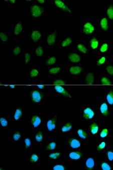 NEDD8 Antibody - Immunofluorescence analysis of HeLa cells.