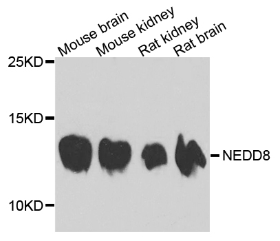 NEDD8 Antibody - Western blot analysis of extracts of various cell lines, using NEDD8 antibody at 1:1000 dilution. The secondary antibody used was an HRP Goat Anti-Rabbit IgG (H+L) at 1:10000 dilution. Lysates were loaded 25ug per lane and 3% nonfat dry milk in TBST was used for blocking. An ECL Kit was used for detection and the exposure time was 60s.