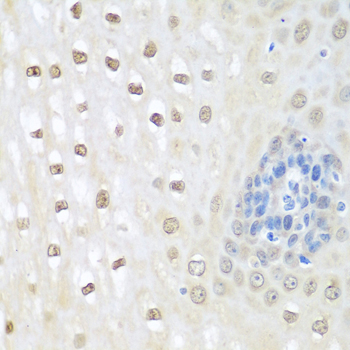 NEDD8 Antibody - Immunohistochemistry of paraffin-embedded human esophagus using NEDD8 antibodyat dilution of 1:100 (40x lens).