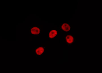 NEDD8 Antibody - Staining COS7 cells by IF/ICC. The samples were fixed with PFA and permeabilized in 0.1% Triton X-100, then blocked in 10% serum for 45 min at 25°C. The primary antibody was diluted at 1:200 and incubated with the sample for 1 hour at 37°C. An Alexa Fluor 594 conjugated goat anti-rabbit IgG (H+L) Ab, diluted at 1/600, was used as the secondary antibody.