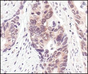 NEDD8 Antibody - IHC of paraffin-embedded human colon carcinoma