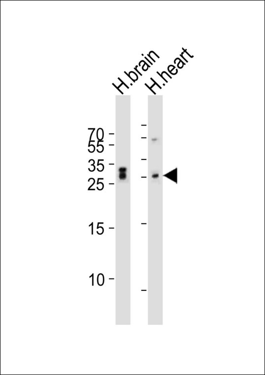NEDF / VPS24 Antibody - Western blot of lysates from human brain and human heart tissue lysate (from left to right), using CHMP3 antibody diluted at 1:1000 at each lane. A goat anti-rabbit IgG H&L (HRP) at 1:10000 dilution was used as the secondary antibody. Lysates at 20 ug per lane.